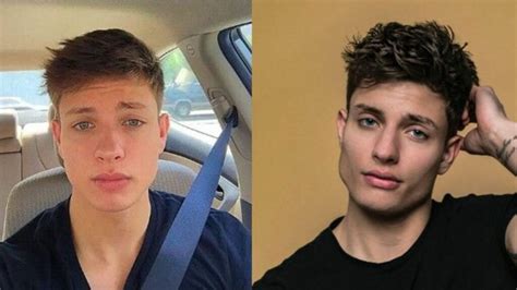 matt rife cosmetic surgery